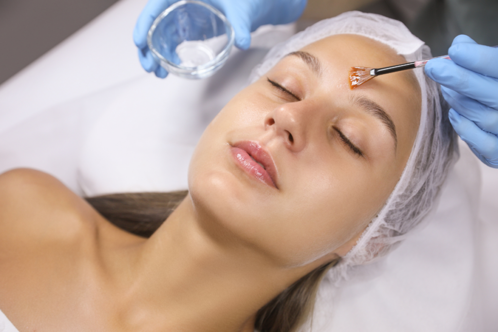 woman receiving chemical peel