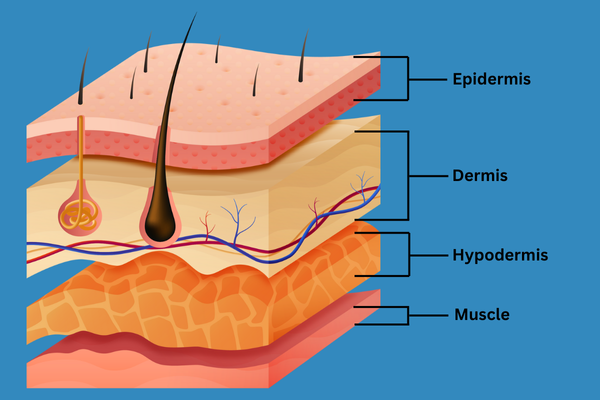 Simple graphic showing the layers of the skin