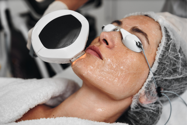 Woman receiving IPL treatment at a MedSpa