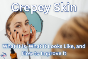 Crepey Skin (header)