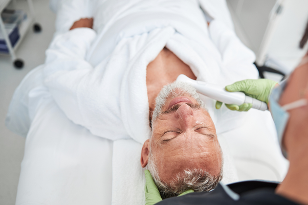 Man addressing uneven skin tone issues with IPL Photofacial treatment