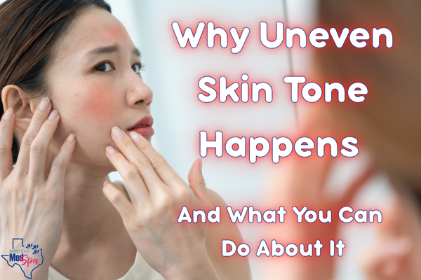 Why Uneven Skin Tone Happens (featured image)
