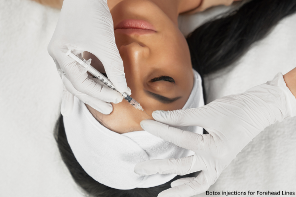 Woman receiving Botox injections in her forehead as part of a Liquid Facelift; image attained from https___www.canva.com_photos_MADzwyV8I6o